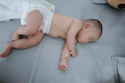 仁怀宝宝脸上有白色斑块